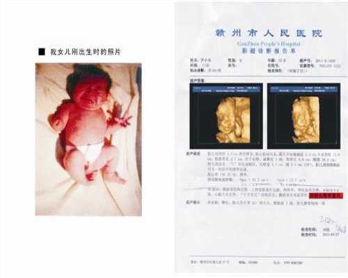 武汉代孕怎样的_武汉在哪里可以找到代孕母_喜孕助孕中心：输卵管介入专家